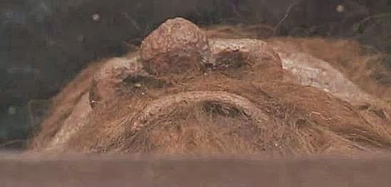 Not even Breathe Right strips are going to help this dude. 